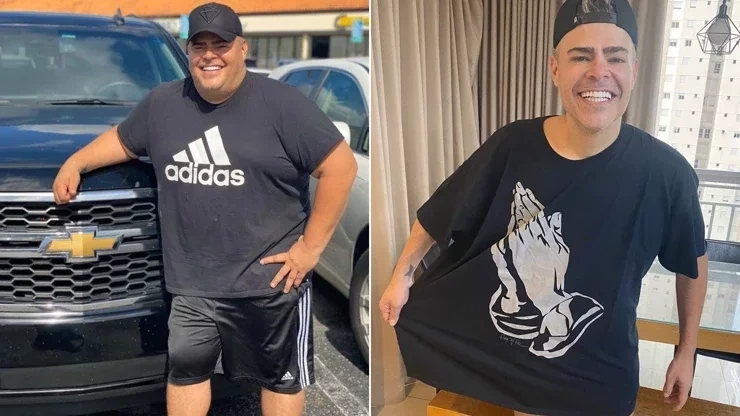 Surpreenda-se!Antes e depois de famosos que fizeram cirurgia para emagrecer - imagem 55308