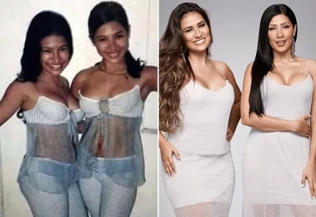 Reconhece? Veja a evolução de 9 famosos brasileiros antes e depois da fama - imagem 57387