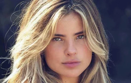 Relembre 12 famosos que já sofreram acidentes domésticos