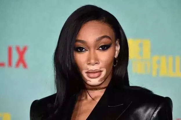 Conheça 10 modelos que fazem sucesso e desafiam o estereótipo da beleza - imagem 60183