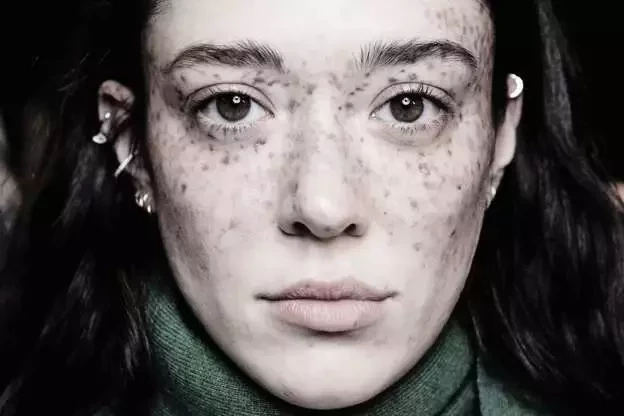 Conheça 10 modelos que fazem sucesso e desafiam o estereótipo da beleza - imagem 60192