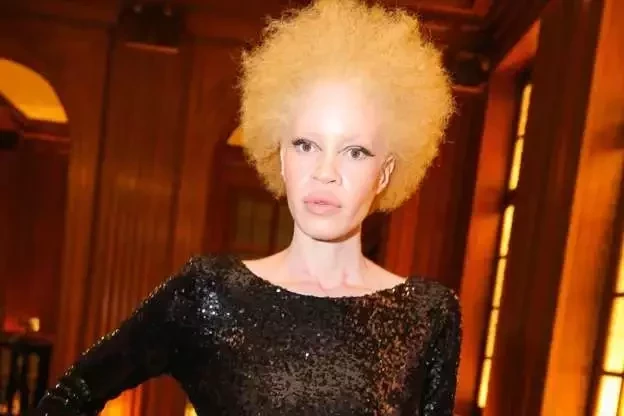 Conheça 10 modelos que fazem sucesso e desafiam o estereótipo da beleza - imagem 60188