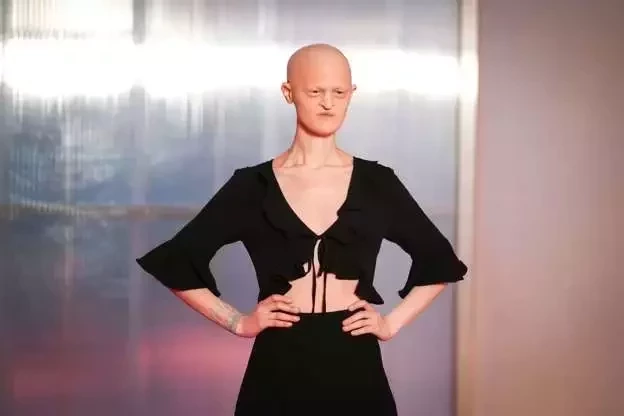 Conheça 10 modelos que fazem sucesso e desafiam o estereótipo da beleza - imagem 60191