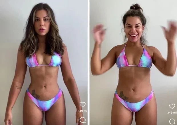 Era dos naturais: veja as famosas que optaram pela retirada do silicone - imagem 58440