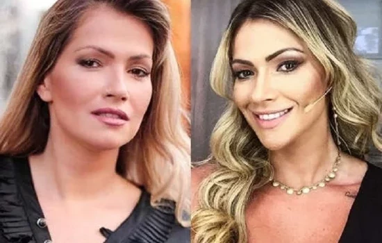Antes e depois: veja como estes famosos ficaram após a harmonização facial