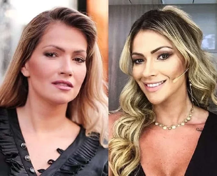 Antes e depois: veja como estes famosos ficaram após a harmonização facial - imagem 63659