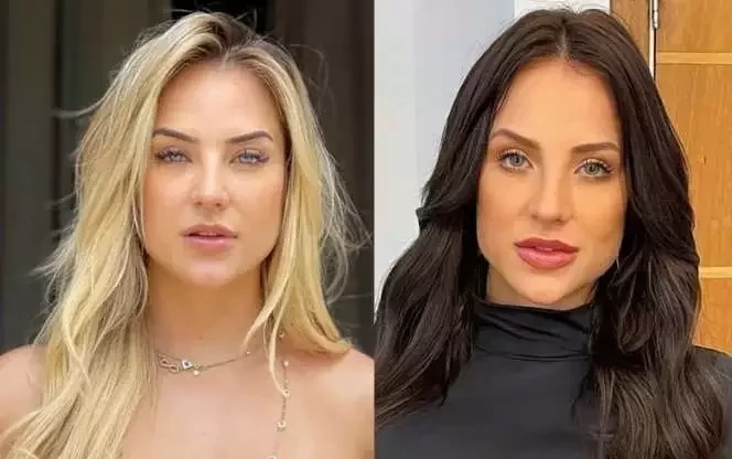 Antes e depois: veja como estes famosos ficaram após a harmonização facial - imagem 63657