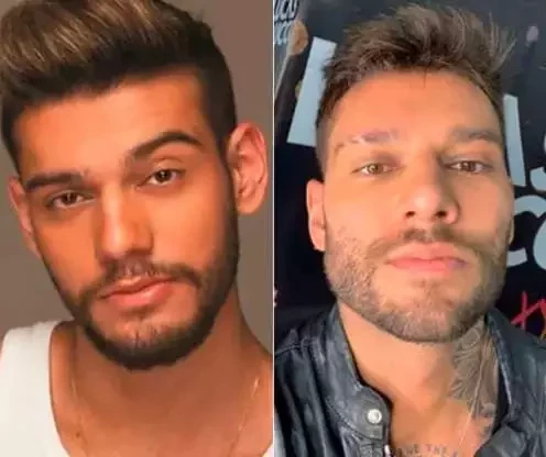 Antes e depois: veja como estes famosos ficaram após a harmonização facial - imagem 63650