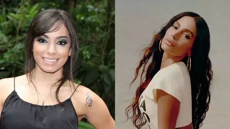 Procedimentos estéticos: surpreenda-se com o antes e depois dos famosos - imagem 62772