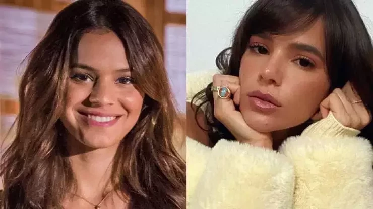 Procedimentos estéticos: surpreenda-se com o antes e depois dos famosos - imagem 62771