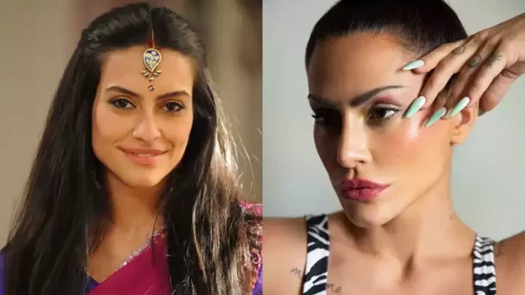 Procedimentos estéticos: surpreenda-se com o antes e depois dos famosos - imagem 62765