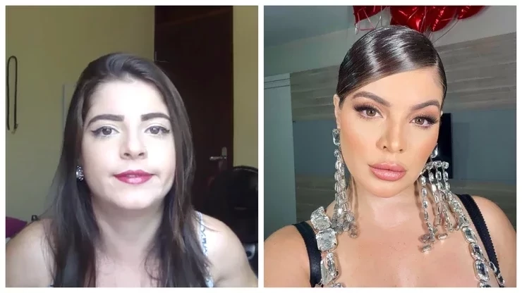 Procedimentos estéticos: surpreenda-se com o antes e depois dos famosos - imagem 62764