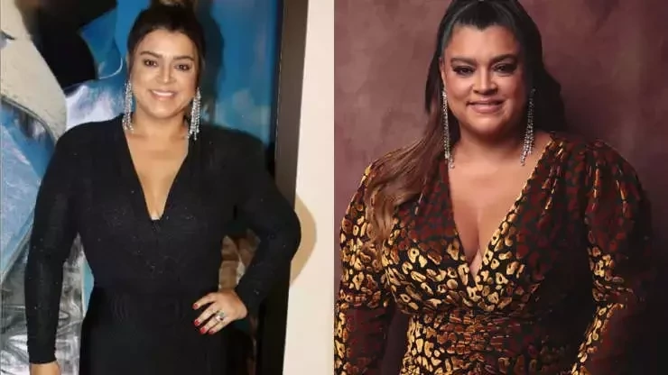 Procedimentos estéticos: surpreenda-se com o antes e depois dos famosos - imagem 62773