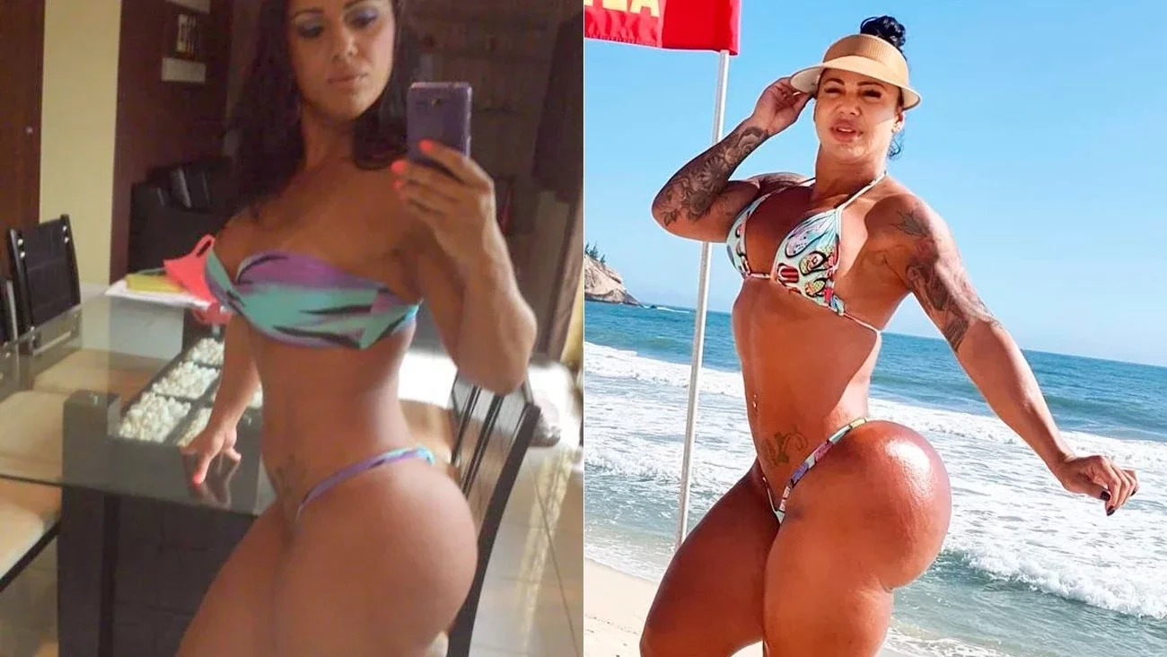 Modelo mostra 'antes e depois' do bumbum de 126cm e impressiona; fotos - imagem 34093