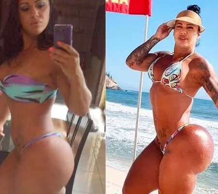 Modelo mostra 'antes e depois' do bumbum de 126cm e impressiona; fotos
