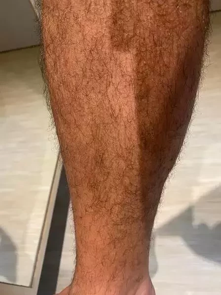 Antes de morrer, Tom Veiga acusou ex de agressão e mostrou fotos - imagem 36040