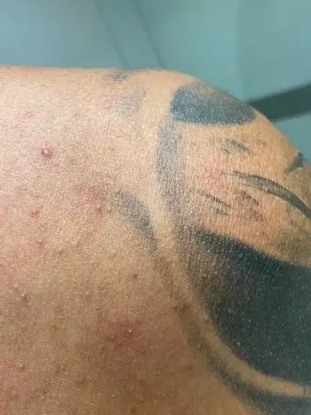 Antes de morrer, Tom Veiga acusou ex de agressão e mostrou fotos - imagem 36039