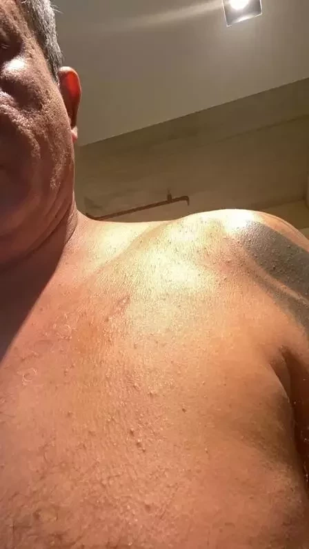 Antes de morrer, Tom Veiga acusou ex de agressão e mostrou fotos - imagem 36036