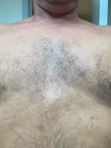 Antes de morrer, Tom Veiga acusou ex de agressão e mostrou fotos - imagem 36041