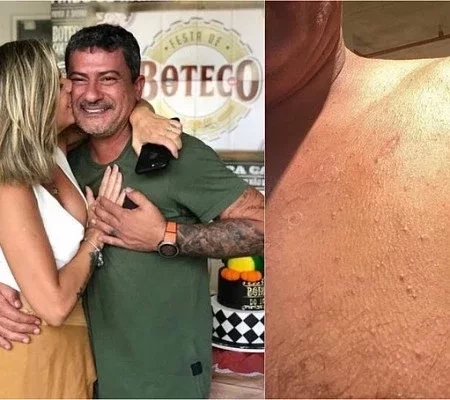Antes de morrer, Tom Veiga acusou ex de agressão e mostrou fotos
