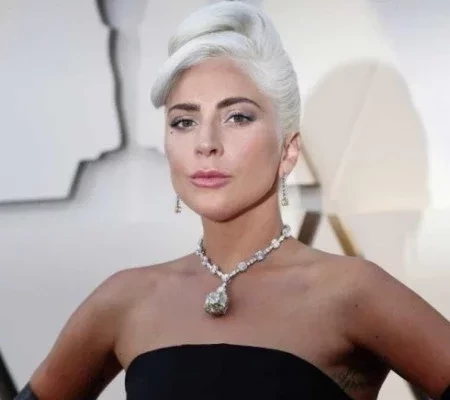 Artistas que convivem com Lúpus e você nem imaginava