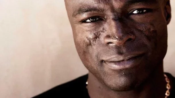 Artistas que convivem com Lúpus e você nem imaginava - imagem 39430