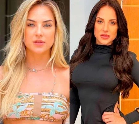 Confira o antes e depois dos famosos que fizeram harmonização facial