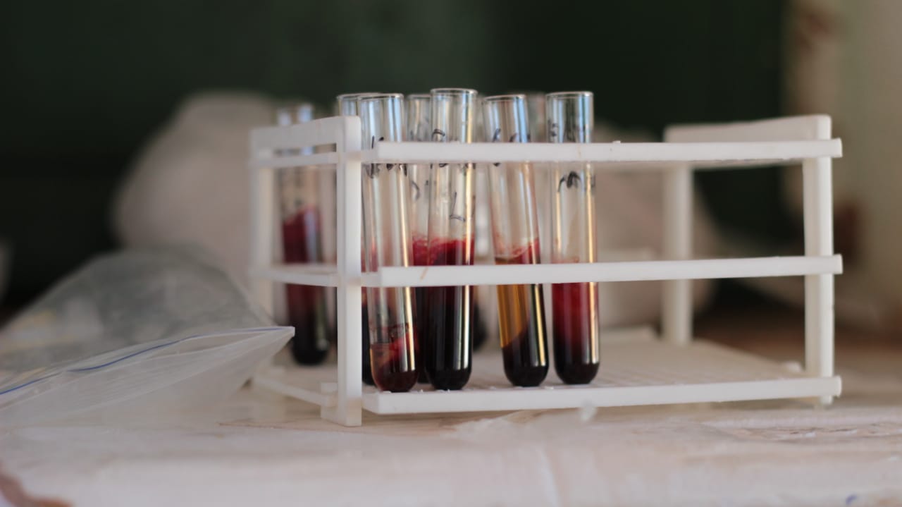 Saúde de Pimenteiras realiza busca ativa de sintomáticos para COVID-19 - Imagem 2