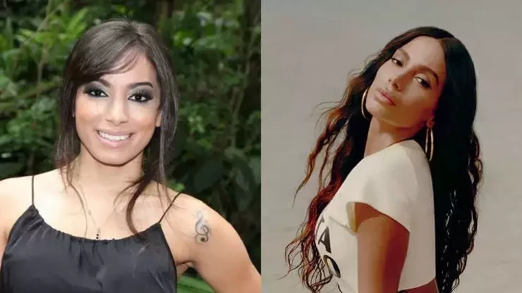 Veja o antes e depois de famosos que fizeram procedimentos estéticos - imagem 41025