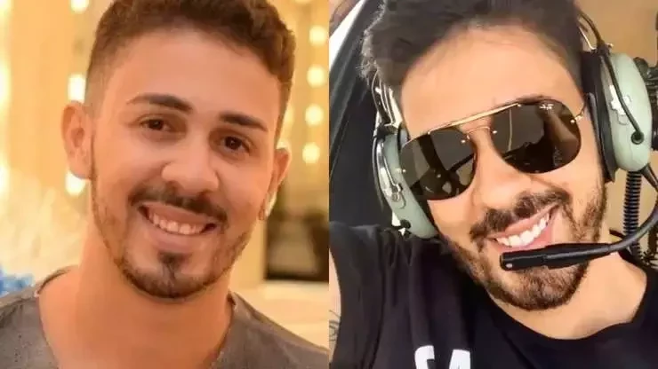 Veja o antes e depois de famosos que fizeram procedimentos estéticos - imagem 41031