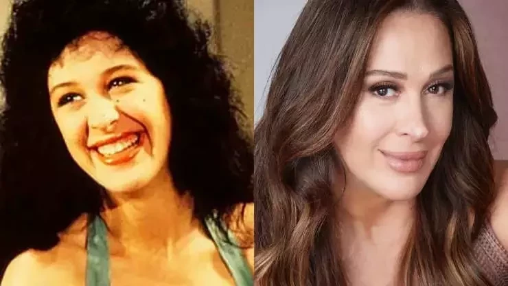 Veja o antes e depois de famosos que fizeram procedimentos estéticos - imagem 41023