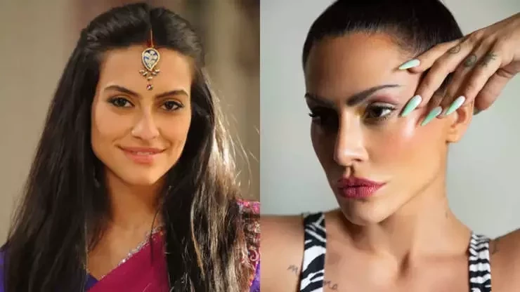 Veja o antes e depois de famosos que fizeram procedimentos estéticos - imagem 41028