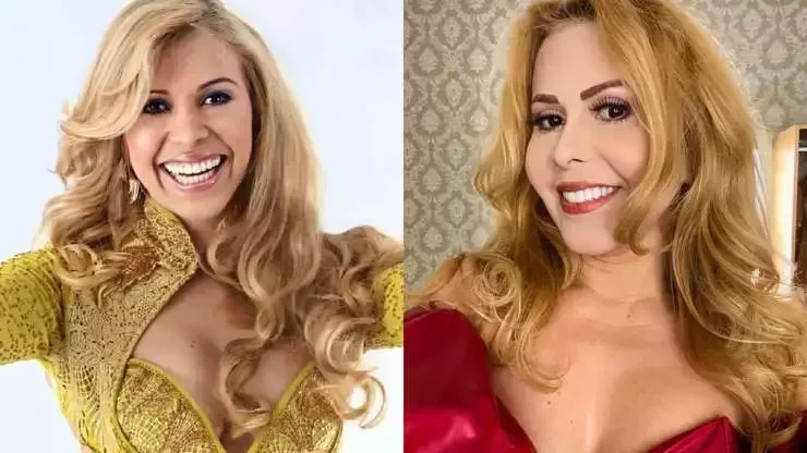 Veja o antes e depois de famosos que fizeram procedimentos estéticos - imagem 41022