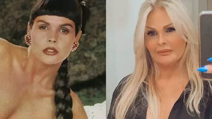 Veja o antes e depois de famosos que fizeram procedimentos estéticos - imagem 41030