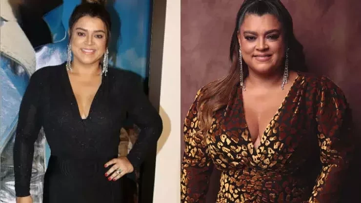 Veja o antes e depois de famosos que fizeram procedimentos estéticos - imagem 41027