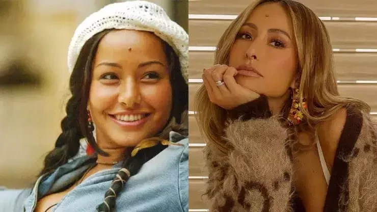 Veja o antes e depois de famosos que fizeram procedimentos estéticos - imagem 41035