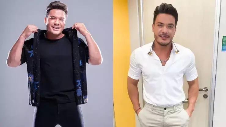 Veja o antes e depois de famosos que fizeram procedimentos estéticos - imagem 41029