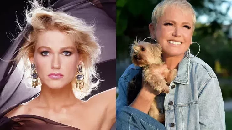 Veja o antes e depois de famosos que fizeram procedimentos estéticos - imagem 41021