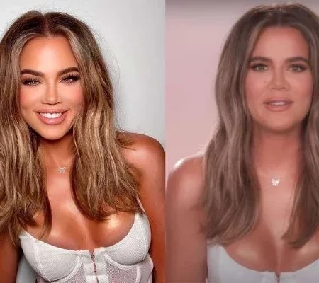 Confira os famosos que fizeram retoque exagerado nas fotos