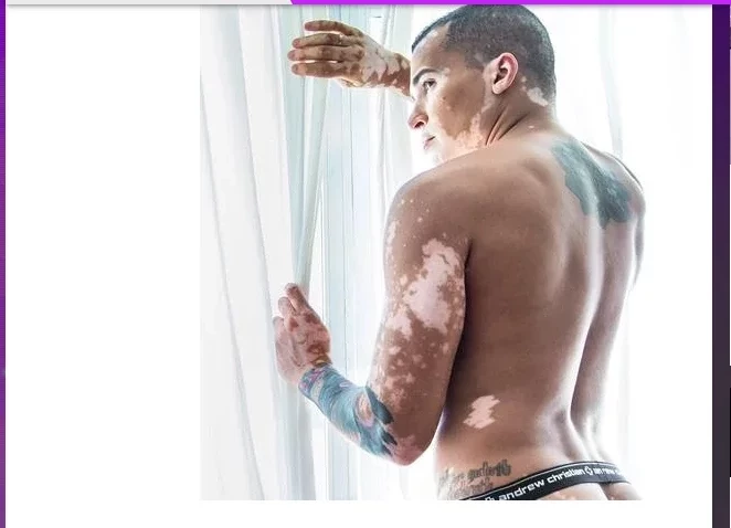 Modelo supera depressão depois de se aceitar e faz sucesso na carreira - imagem 48406