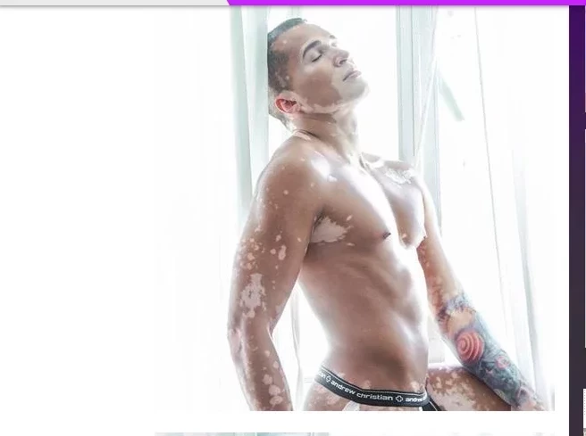 Modelo supera depressão depois de se aceitar e faz sucesso na carreira - imagem 48407