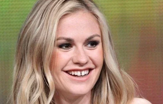 Confira as celebridades com dentes ruins; mudança surpreende