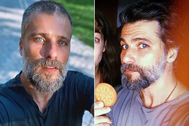 Celebridades que fizeram plástica e que você nem sabia - imagem 50116