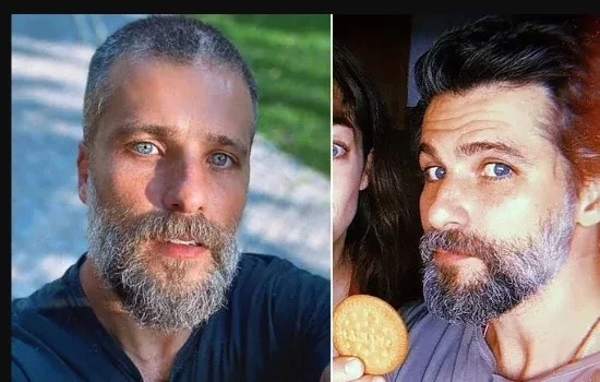 Celebridades que fizeram plástica e que você nem sabia