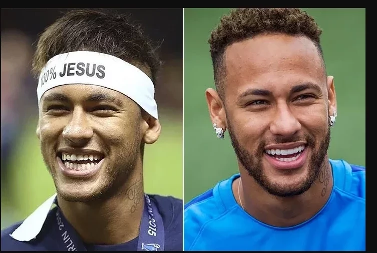 Celebridades que fizeram plástica e que você nem sabia - imagem 50115