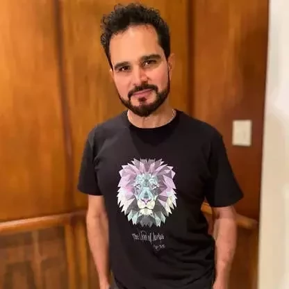 Adeus careca!Veja antes e depois de famosos que fizeram transplante capilar - imagem 53718