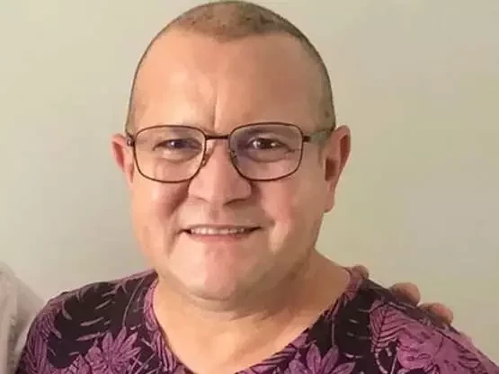 Adeus careca!Veja antes e depois de famosos que fizeram transplante capilar - imagem 53726