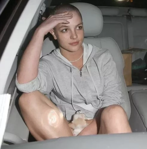 Além de Britney Spears! Veja 16 mulheres que ficaram maravilhosas carecas - imagem 66850