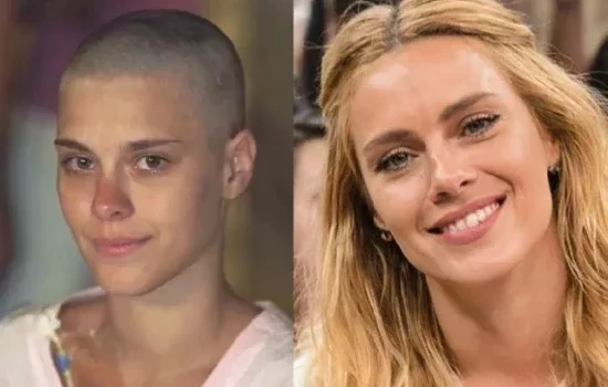 Carolina Dieckmann não foi a única: veja famosas que já ficaram carecas