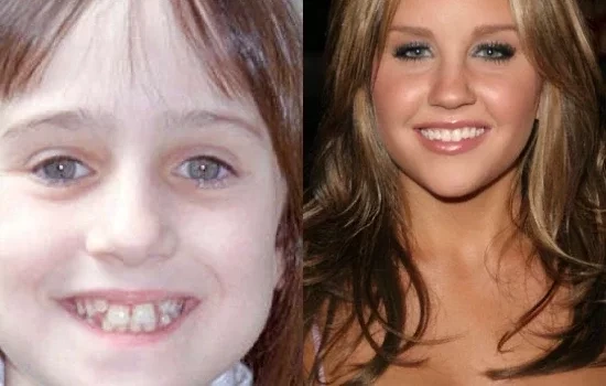 Confira 10 celebridades que se aposentaram de forma muito precoce 